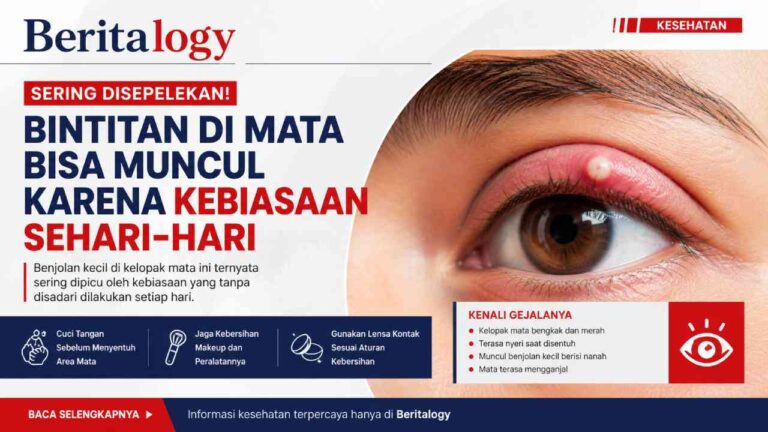 Mata Tiba-Tiba Bintitan? Ternyata Kebiasaan Sehari-hari Bisa Jadi Penyebab