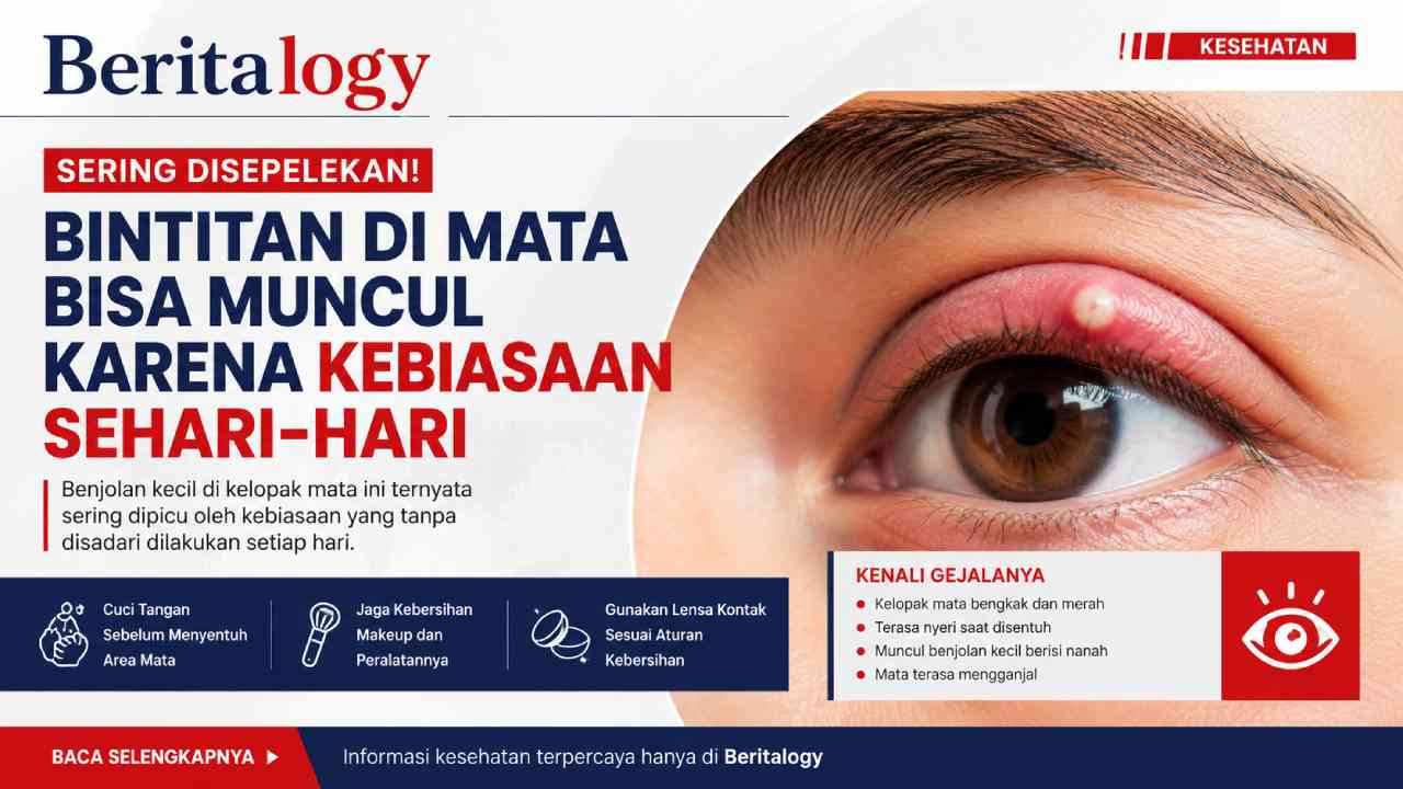 Mata Tiba-Tiba Bintitan? Ternyata Kebiasaan Sehari-hari Bisa Jadi Penyebab