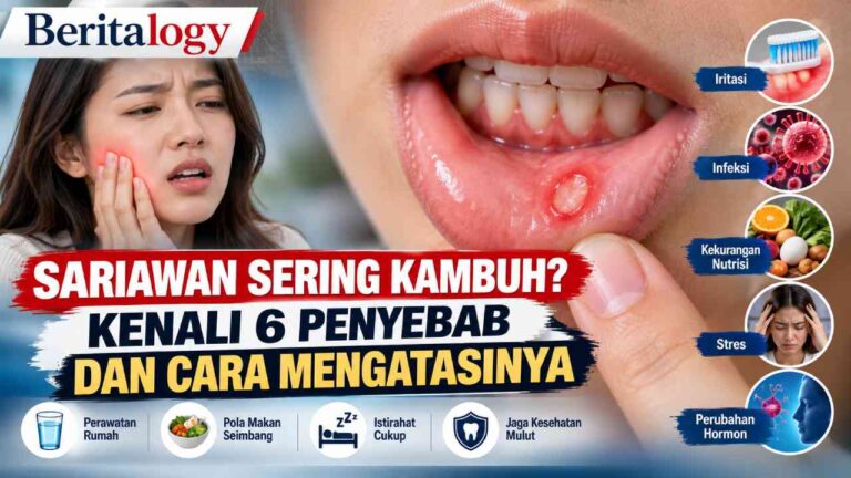 Sariawan Sering Kambuh? Kenali 6 Penyebab dan Cara Mengatasinya