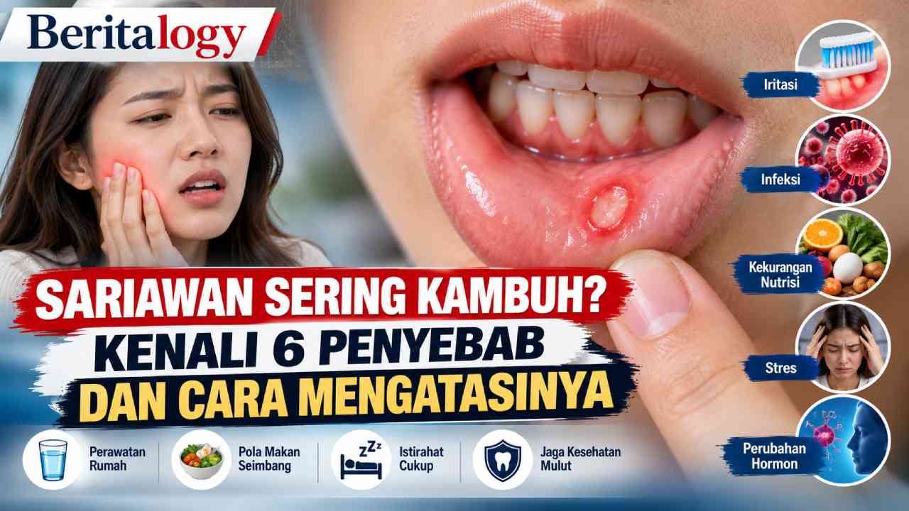 Sariawan Sering Kambuh? Kenali 6 Penyebab dan Cara Mengatasinya